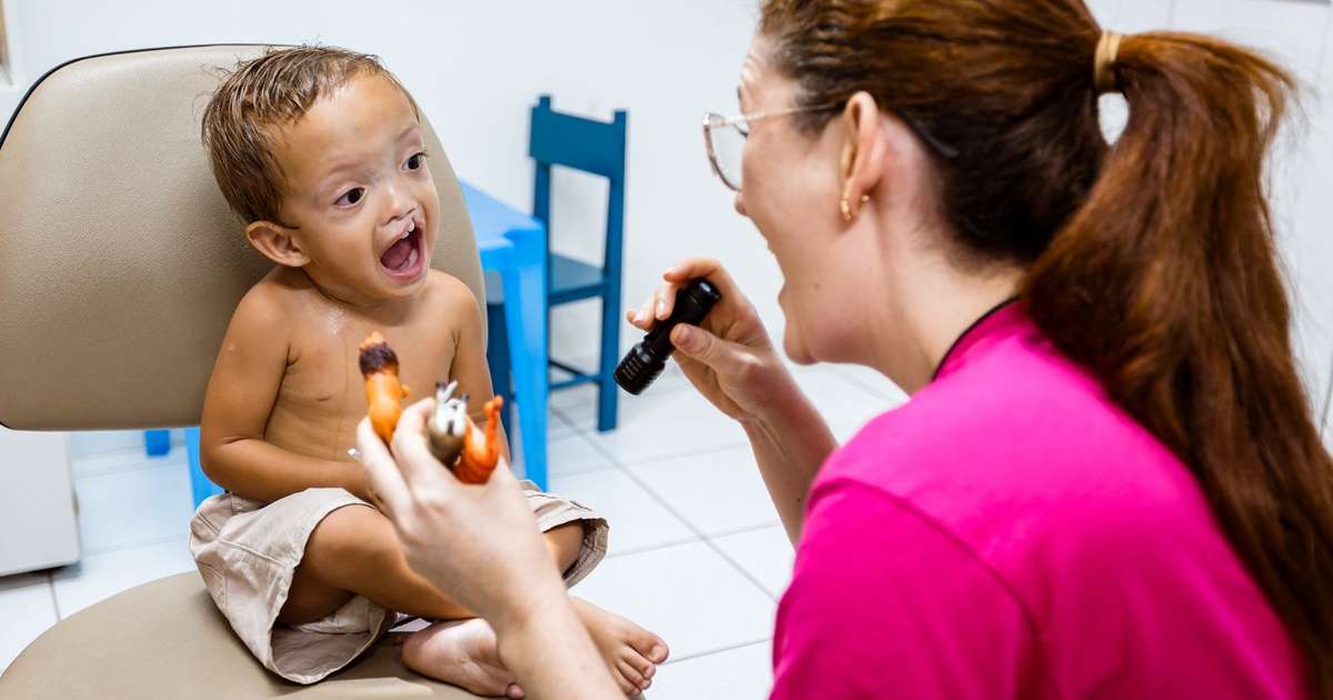 Mutirão gratuito para fissura labiopalatina começa em SP e prevê 35 cirurgias