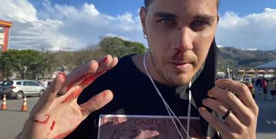 Leandro Matozo foi atacado h&aacute; 5 anos, quando cobria a programa&ccedil;&atilde;o no Santu&aacute;rio de Aparecida Foto: Reprodu&ccedil;&atilde;o
